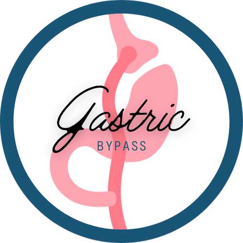 Gastric Bypass illustration