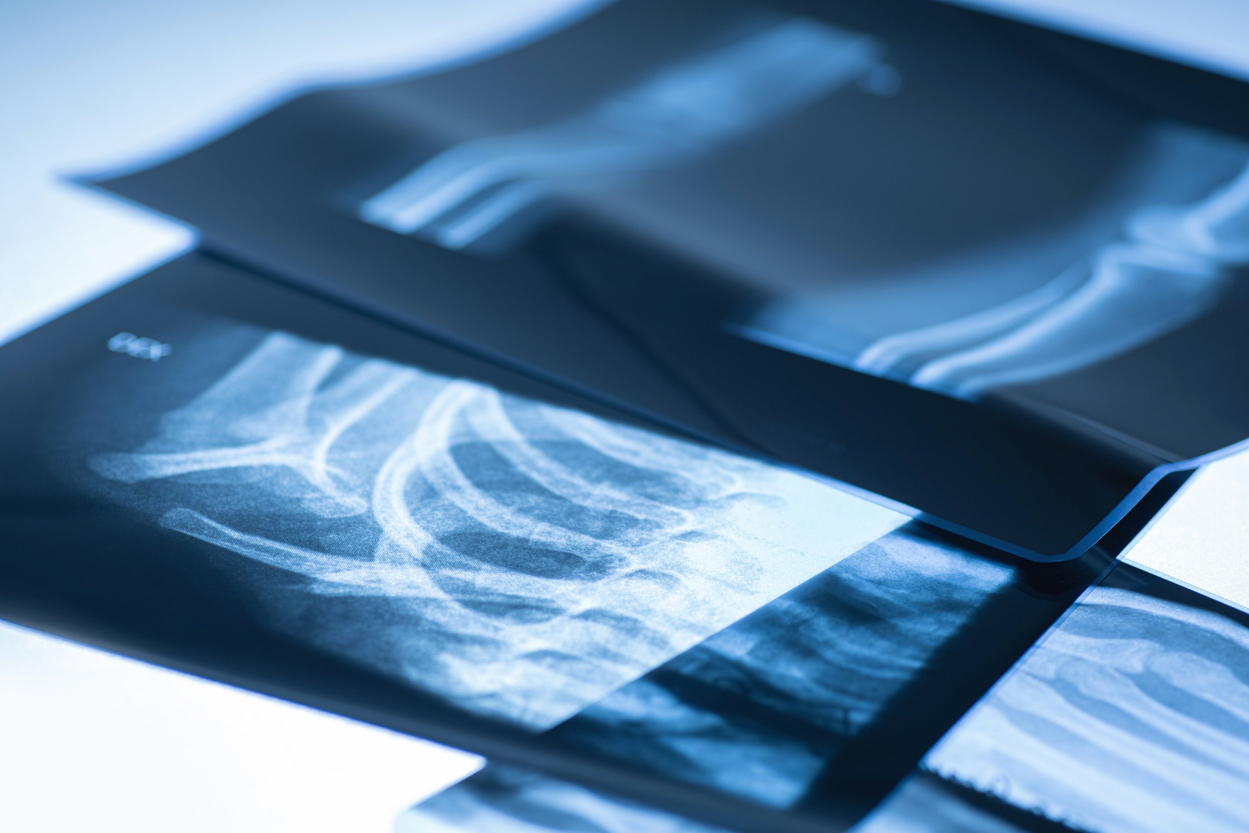 Closeup of X-ray images
