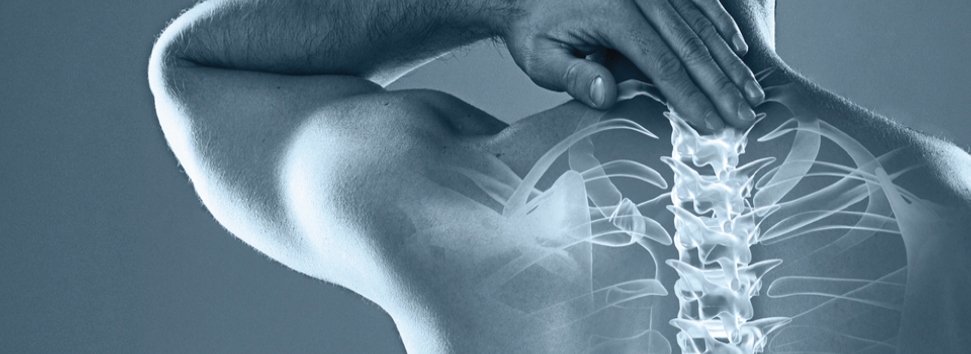 X-ray view of a spine and shoulders